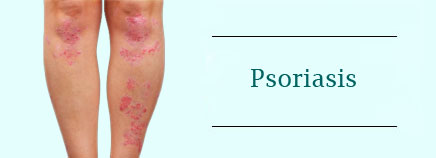 p-psoriasis-enhd-ar1